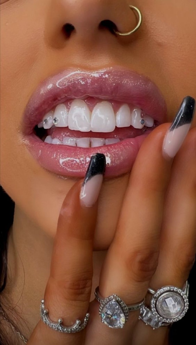Bijou dentaire strass